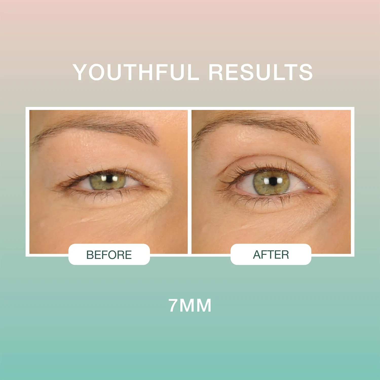 Contours Rx Lids by Design - Non-Surgical & Transparent Eyelid Lift Strips - for a More Youthful-Looking Appearance, Lid Lifting Treatment, Eyelid Tape for Hooded Eyes (7mm) 80ct